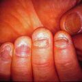 misuse_flu_spo2000-161.jpg