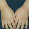 misuse_fucidin020112.jpg