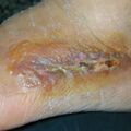 misuse_furacin020304.jpg