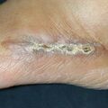 misuse_furacin020311.jpg