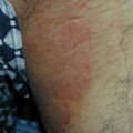 misuse_gammalin020729-1.jpg