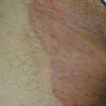 misuse_gammalin020729-2.jpg