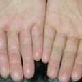 misuse_hanibal020820-1.jpg