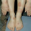 misuse_herb010221-1.jpg