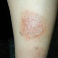 misuse_herb010221-2.jpg