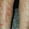 misuse_herb020226-1.jpg