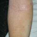 misuse_herb020805-1.jpg