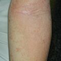 misuse_herb020805-2.jpg