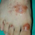 misuse_herb020805-3.jpg
