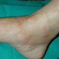 misuse_herb0208072.jpg