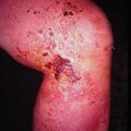 misuse_herb2000-108.jpg