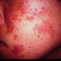 misuse_herb2000-138.jpg