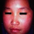 misuse_icd_udina2000-72.jpg