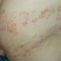 misuse_ig020824-1.jpg
