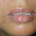 misuse_isozym020823.jpg