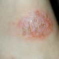misuse_isozyme010803.jpg