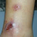 misuse_isozyme020102.jpg