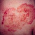 misuse_lacticare9-845.jpg