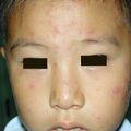 misuse_lacticarehc020718-1.jpg