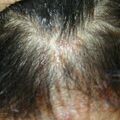 misuse_lacticarehc020718-2.jpg