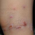 misuse_lacticarehc020816.jpg