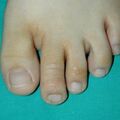 misuse_lamisil020727-1.jpg