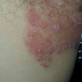 misuse_lavenda010609.jpg