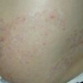 misuse_lavenda020531.jpg
