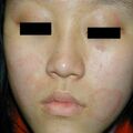 misuse_lavenderm010331.jpg