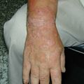 misuse_lestone010806-1.jpg