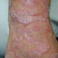 misuse_lestone010806-2.jpg