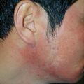 misuse_lidomex010326-2.jpg