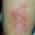 misuse_lidomex010530-1.jpg