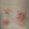 misuse_lidomex010530-2.jpg