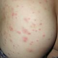 misuse_lindane020820-3.jpg