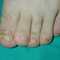 misuse_loprox010425-1.jpg