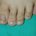 misuse_loprox010630.jpg