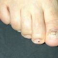 misuse_loprox010802.jpg