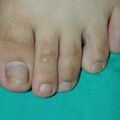 misuse_loprox010918-2.jpg