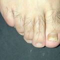 misuse_loprox010918.jpg