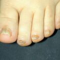 misuse_loprox020105.jpg