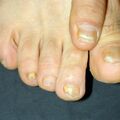 misuse_loprox020209.jpg