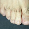 misuse_loprox020308.jpg