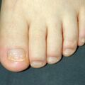 misuse_loprox020722.jpg