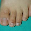 misuse_loprox020902.jpg