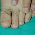 misuse_loprox021018.jpg