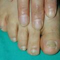 misuse_loprox021210.jpg