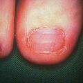 misuse_loprox9-1068.jpg
