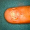 misuse_loprox9-339.jpg