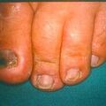 misuse_loprox9-683.jpg